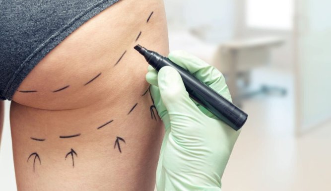 Chirurgie à tout prix | Botched (Would You Like Pepperoni on Those Boobs?)