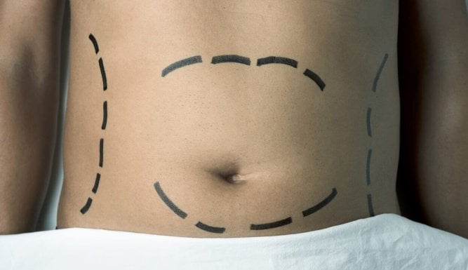 Chirurgie à tout prix