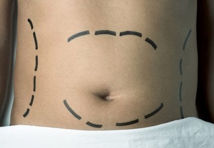 Téléréalité : Chirurgie à tout prix